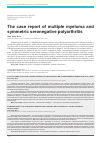 Научная статья на тему 'The case report of multiple myeloma and symmetric seronegative polyarthritis'